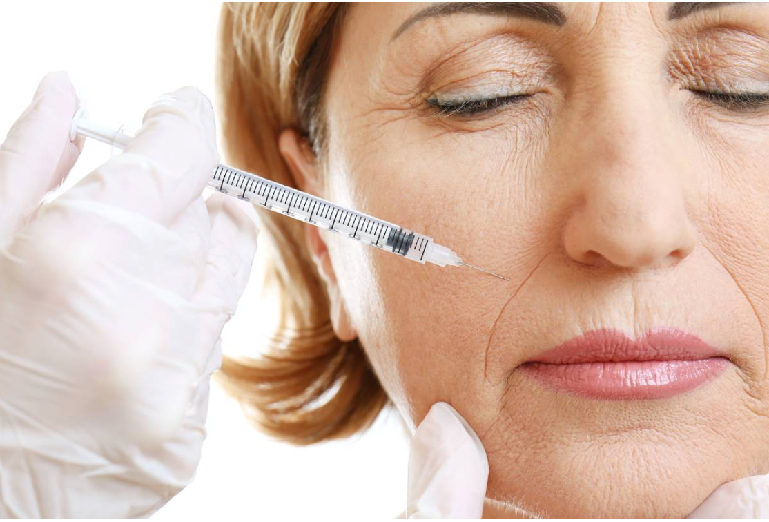 Rellenos Dérmicos: Rejuvenece y Define tu Rostro con Resultados Naturales