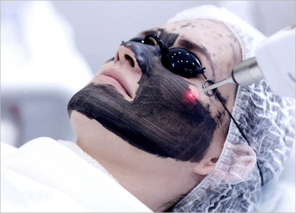 Laser Hollywood Peel