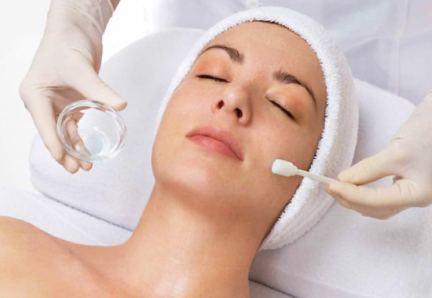 Peeling Químico: Renueva tu Piel y Despierta su Brillo Natural