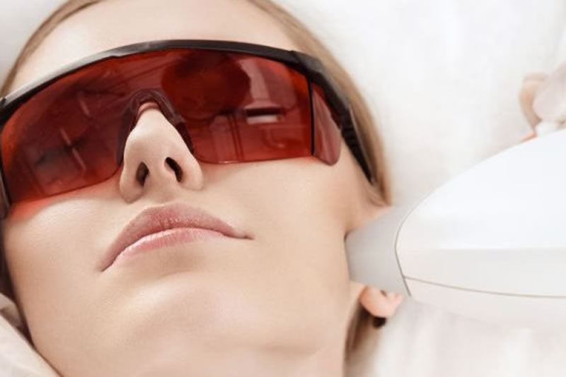 Patillas - Láser Depilación IPL Exilite ¡No más pelos Faciales!